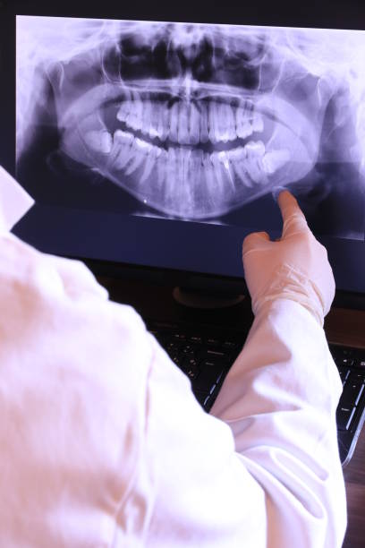 Best Emergency Tooth Extraction in Washington Heights, NY