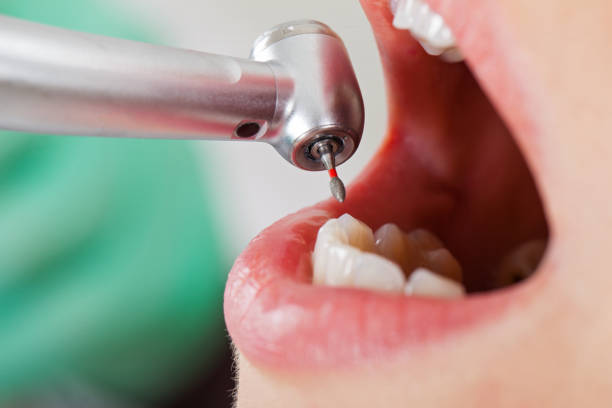 Best Emergency Treatment for Toothache in Washington Heights, NY